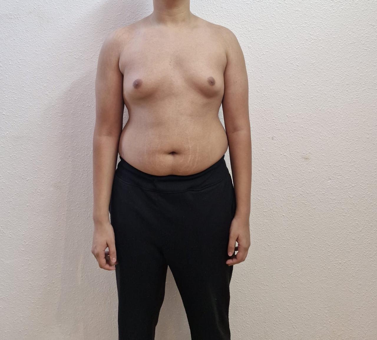 transformation