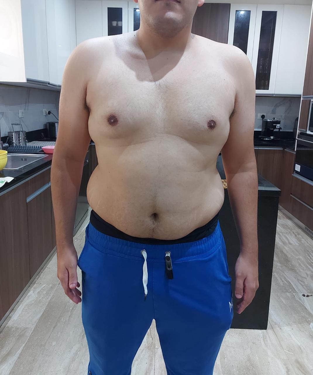 transformation
